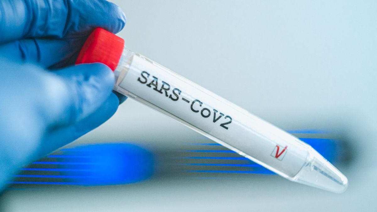 Dezinfoservis: Pro spekulace o umělém vzniku viru SARS-CoV-2 nejsou důkazy